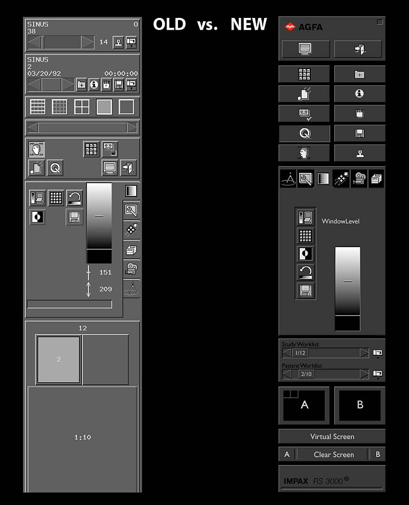 user-interface-design-agfa-impax-old-vs-new-schlagheck-design
